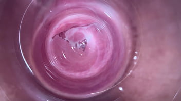 camera inside the anus