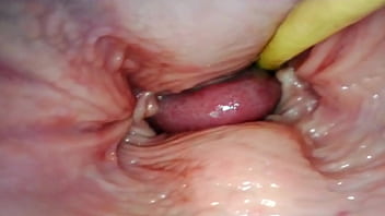 camera inside a womans vagina